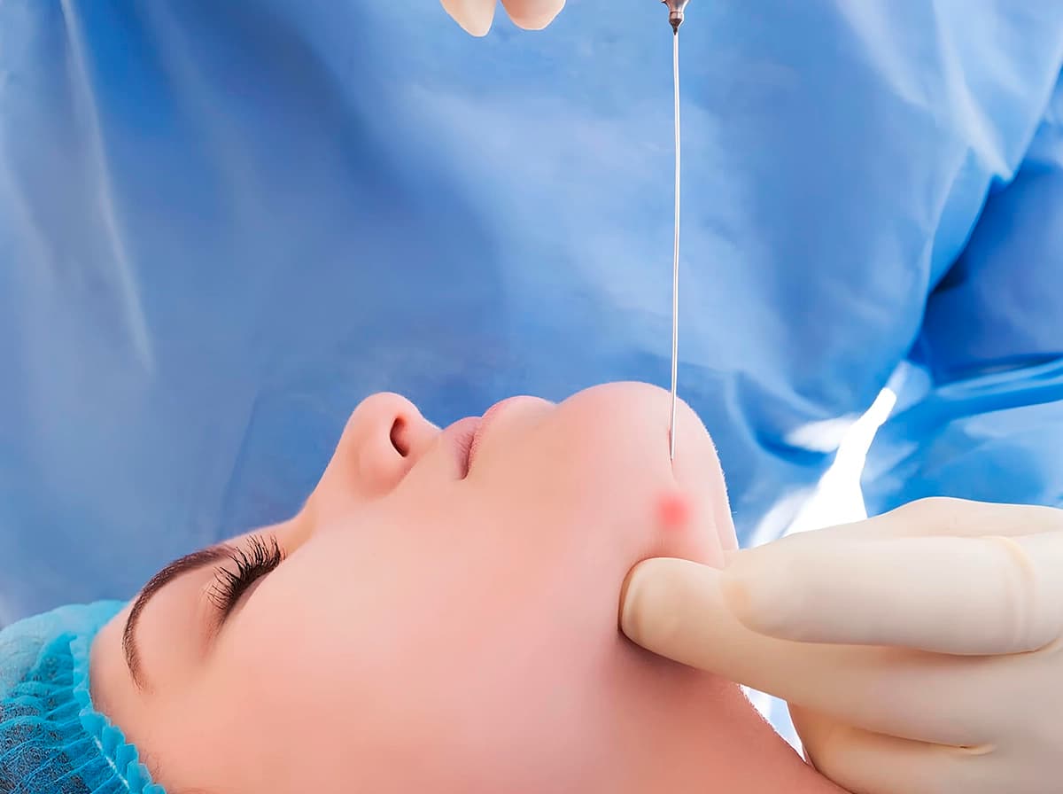 Facetite y Endolifting