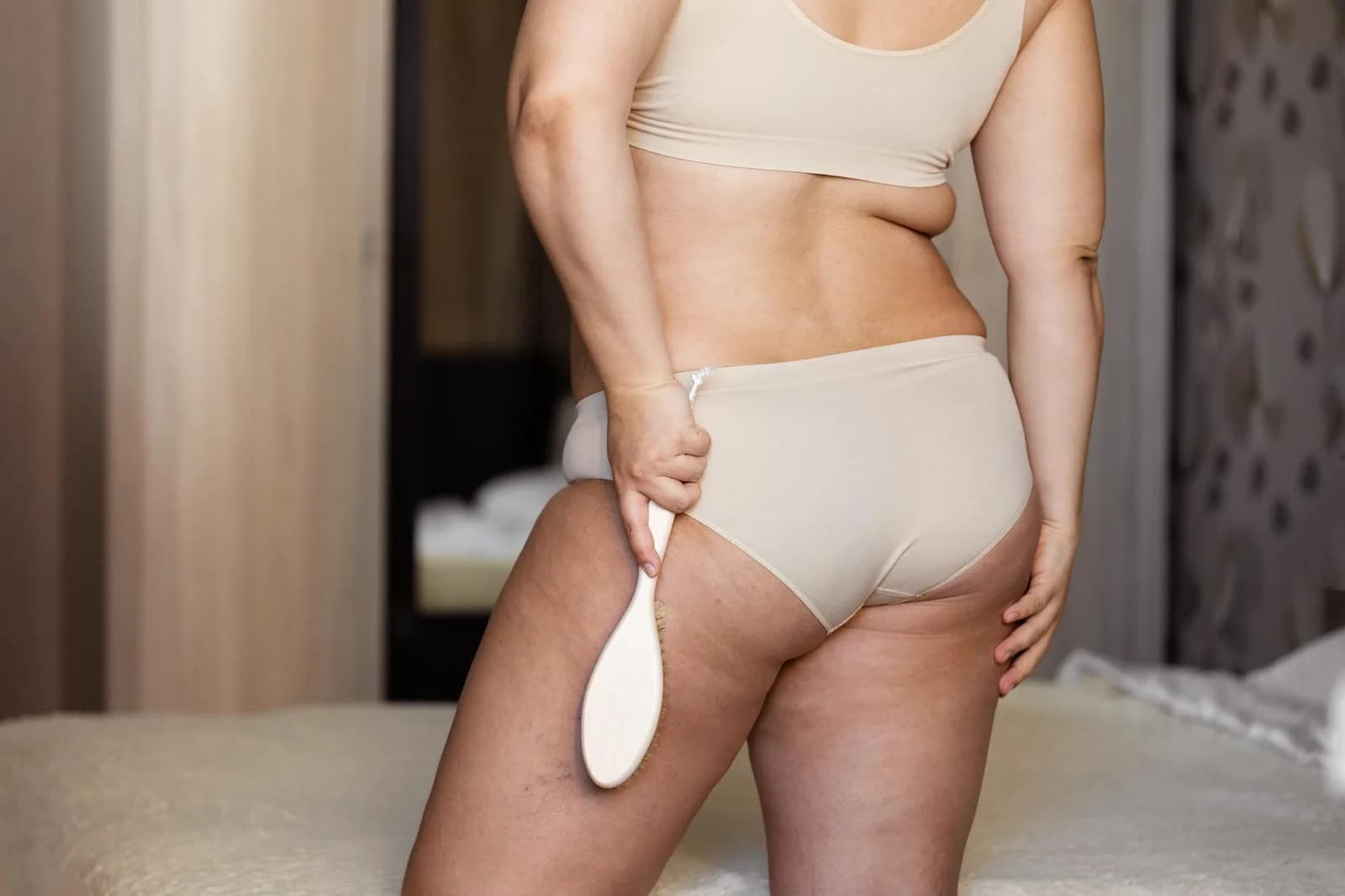 ¿Qué hacer cuando la celulitis aparece en las piernas y no solo en glúteos?